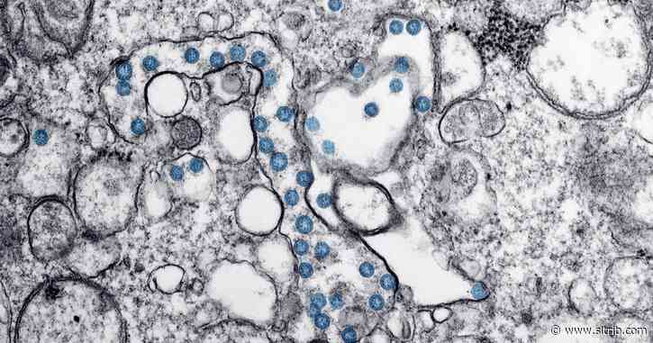 Utah-based ARUP Laboratories to start coronavirus antibody testing