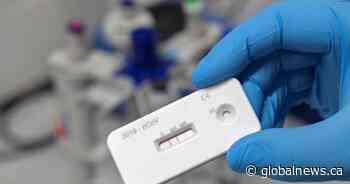 Coronavirus: Saskatchewan exploring antibody testing for the future