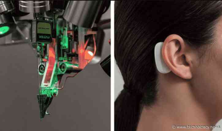 Elon Musk’s Neuralink Brain Interface Ready In Months?