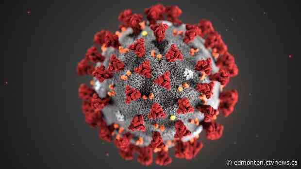 Alberta reports 81 new cases of COVID-19; opens testing to anyone with symptoms