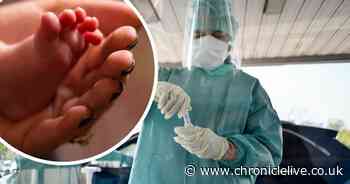 The possible sign of coronavirus to look out for on your feet