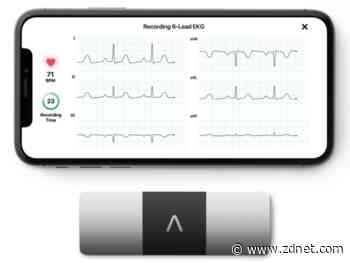 AliveCor uses remote medicine to provide critical heart rhythm testing to COVID-19 patients
