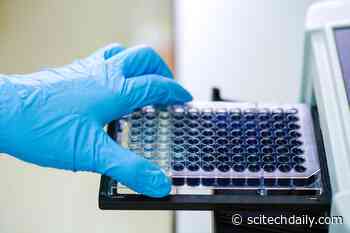 Test for Novel Coronavirus Antibodies Developed at Stanford Medicine