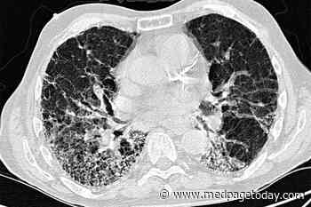 Pre-Op Assessment of Fractured Femur Reveals Sinister Lung Pathology