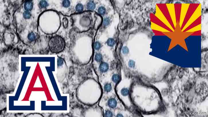 UArizona, Arizona to start COVID-19 antibody large-scale testing