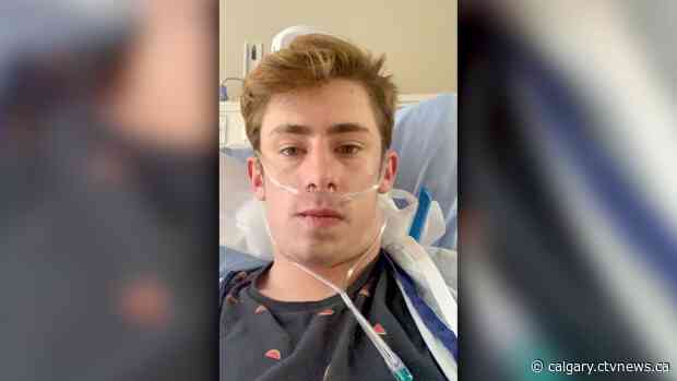 'Scariest experience of my life': Okotoks man becomes youngest ICU patient in Alberta from COVID-19