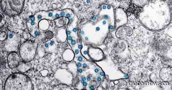 Coronavirus: U of C scientists receive federal funding for antiviral drug research