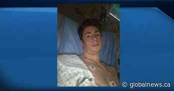 Alberta teen, 19, recounts ICU stay after contracting COVID-19: ‘I was actually really scared’