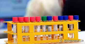 Finding value in daily COVID-19 numbers despite provincial testing differences