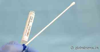 Alberta sees no additional COVID-19 deaths, lower number of ICU patients Wednesday