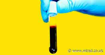 The blood of coronavirus survivors could help tackle the pandemic