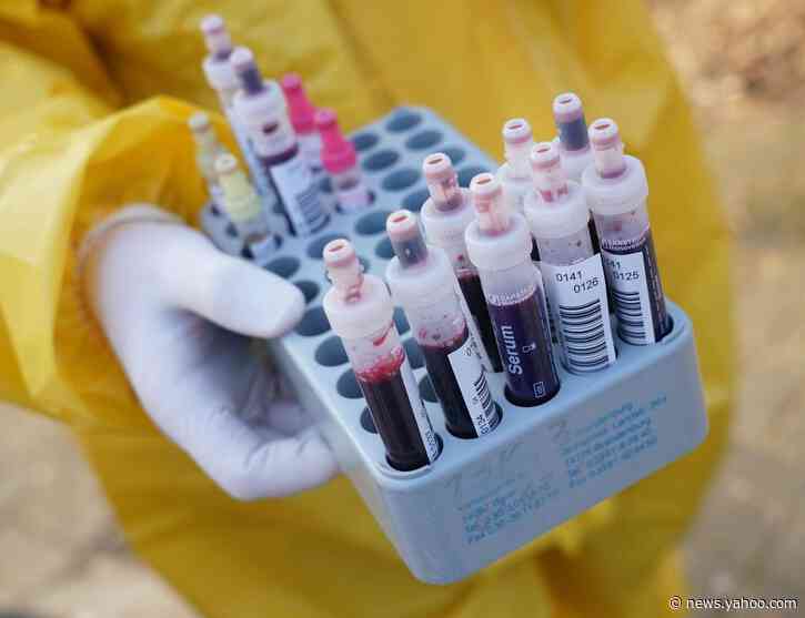 Checking blood for coronavirus antibodies – 3 questions answered about serological tests and immunity