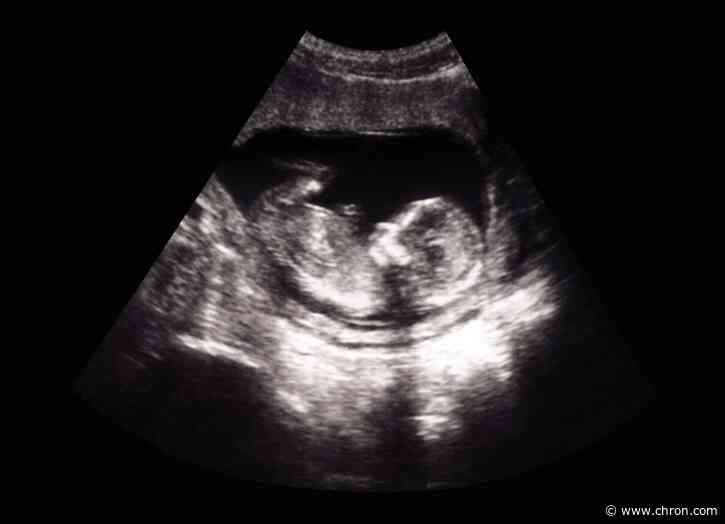 'The weirdest thing is growing this bump by yourself': What pregnancy, birth are like in a pandemic