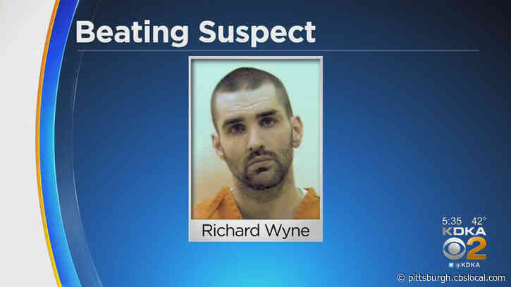 Back-Alley Attack In Westmoreland Co. Leaves Man With Broken Ankle, Broken Jaw And Bleeding Inside Brain