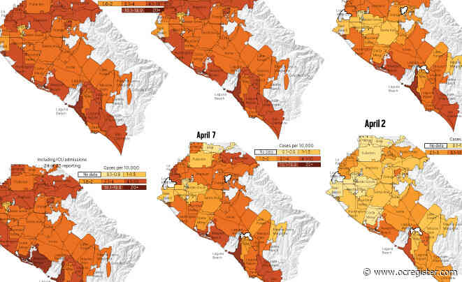 Coronavirus: Orange County has tested more than 18,000 people as of April 20