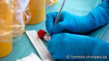 38 new deaths and 551 more cases of COVID-19 in Ontario
