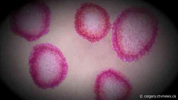 AHS finds northwest Calgary pub, central Alberta restaurant still offering dine-in service