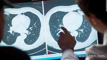 Covid's medical devastation will be felt by millions who never contract the disease - CNN