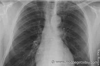 Tx for Worsening Dyspnea Appeared to Help, But Led to Tragic Results