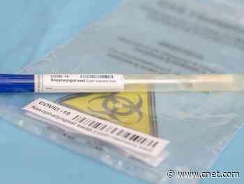 How long does the coronavirus test take and when will I get my COVID-19 results?     - CNET