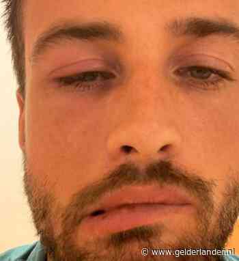 Dave Roelvink naar ziekenhuis met hangend gezicht: ‘Ik zie niks meer’