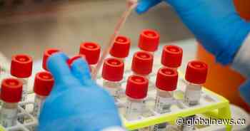 Canadian company says its coronavirus test could enhance screening
