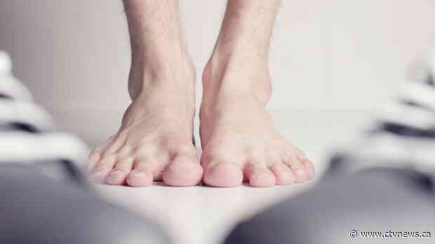 What are 'COVID toes'? Doctors discover new symptom of possible infection