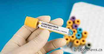 Saskatchewan health officials report 5 new coronavirus cases, 6 hospitalizations