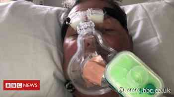 Coronavirus survivor describes ventilator 'nightmare'
