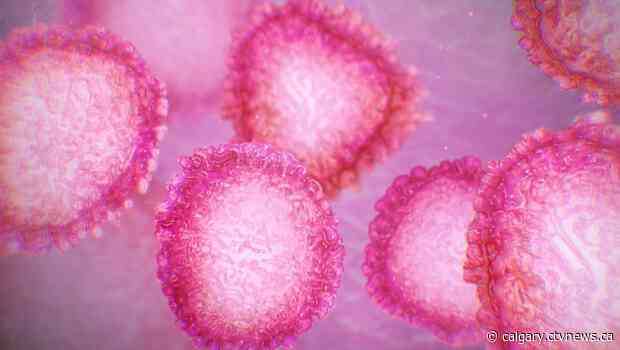 Health officials investigate two possible cases of coronavirus at Okotoks, Alta. chicken plant