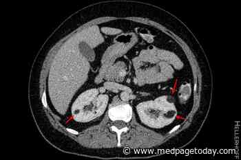 Benign Kidney Tumors Shrink With mTOR Inhibitor