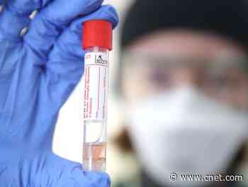 Coronavirus antibody, nasal swab, saliva testing: What to know about COVID-19 tests     - CNET