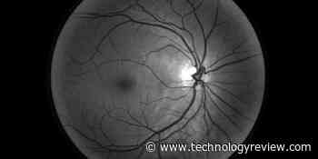 Google’s medical AI was super accurate in a lab. Real life was a different story. - MIT Technology Review