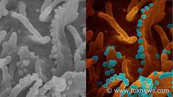 'Devastatingly' effective coronavirus captured in image of cell
