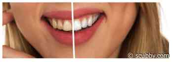 7 Gadgets That Promote Personal Hygiene - Scubby
