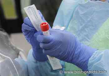 Think you should be tested? Here’s what to do