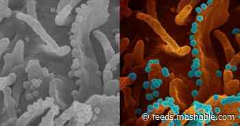 What coronaviruses emerging from a dying cell look like