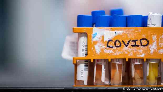 Seven new deaths as total COVID-19 cases in Alberta surpass 5,000