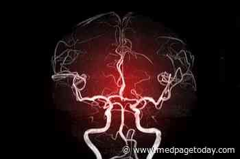 Large Vessel Strokes in Younger Patients Tied to COVID-19
