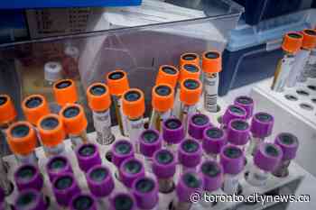 347 new coronavirus cases, 45 new deaths reported in Ontario - CityNews