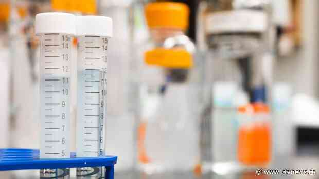 Here are the potential vaccines for COVID-19 being tested in humans