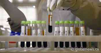 Coronavirus: Rural Albertans needing outpatient lab work now have to make appointments