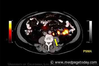 Clinical Challenges: Nuclear Medicine and Neuroendocrine Tumors