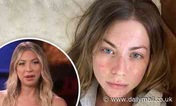 Stassi Schroeder goes makeup-free to reveal what her face looks like with psoriasis