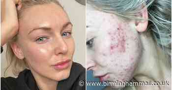 Make-up artist who cured own acne shares lockdown skincare secrets