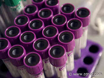 I got Quest's new COVID-19 antibody test and it was strange