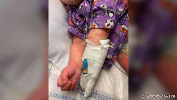 Canadian doctors investigate possible link between COVID-19 and rare children's disease