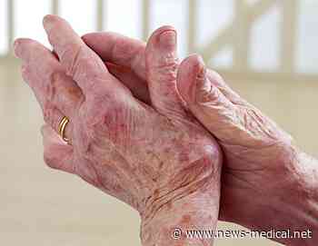 Study: Individuals at high risk of knee arthritis can indulge in vigorous exercise