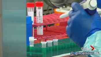 Virology expert concerned about Alberta reopening