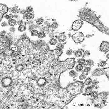 Scientists concerned focus on COVID-19 disrupting regular health research funds